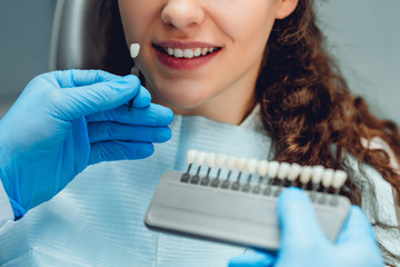 Dentist checking and selecting color of young woman's teeth. Close up view.