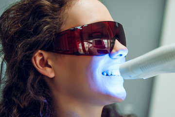 Girl patient in the dental clinic. Teeth whitening UV lamp with photopolymer composition. Side view.