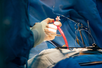 Surgical team operating a patient in an operation theater. Surgeon at work in the hospital. Medicine doctor. Cardiac surgery. Heart transplantation. Surgical equipment and instruments.