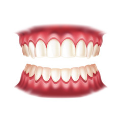 Realistic dentures for dentistry and orthodontics design. Vector human mouth with teeth for medical and toothpaste design. Healthy oral hygiene, jaw prosthesis concept.