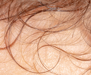 Curly hair on human skin as background, Macro