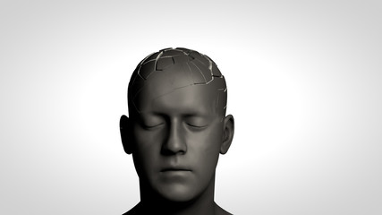 Alzheimer's disease or memory loss