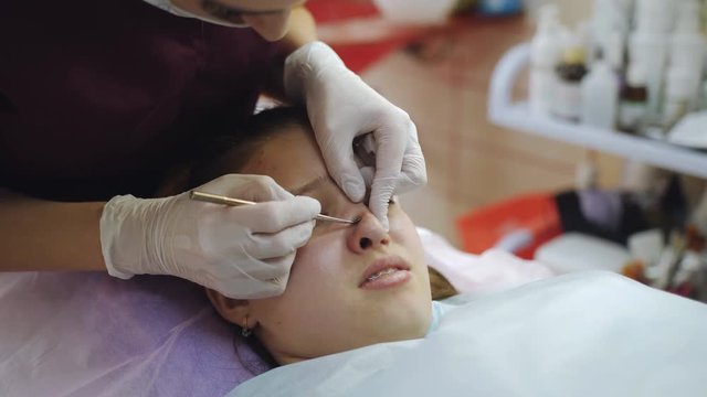Cosmetologist cleaning face teenager close up. Hand with blackhead remover.