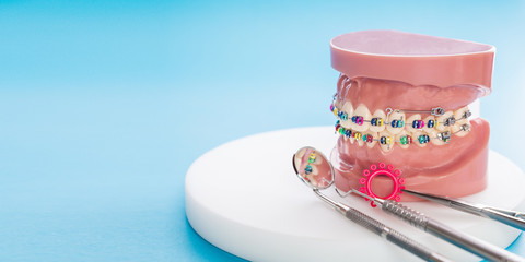 orthodontic model and dentist tool - demonstration teeth model of varities of orthodontic bracket or brace