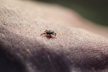 Tick insect parasite crawling on human skin. Hard tick (Ixodes)
