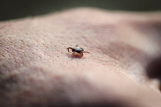 Tick insect parasite crawling on human skin. Hard tick (Ixodes)