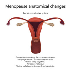 Menopause anatomical changes. Female reproductive system of older woman with explanations. Realistic anatomy vector illustration.