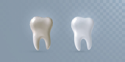 Realistic 3d teeth isolated on transparent background. Vector dentistry illustration. Medical or healthcare concept. Whitening treatment. Before and after ads template