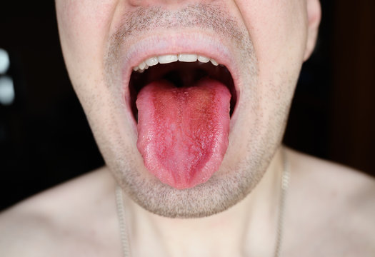 Man shows his red tongue colored by fruit juice.