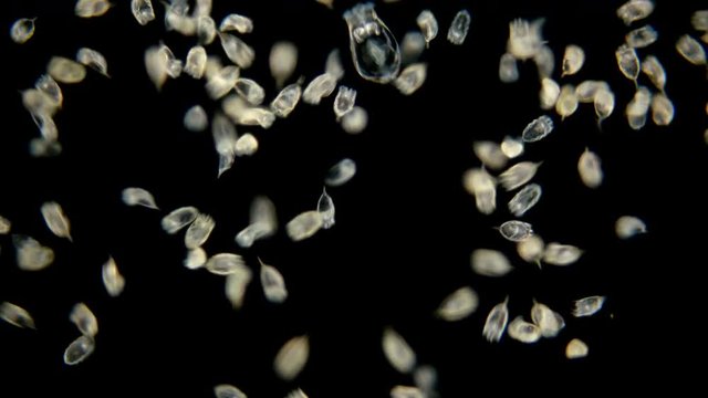Rotifera Keratella Cochlearis under the microscope. The colony of plankton rotifers Rotifera Keratella Cochlearis, distributed throughout the world, both in salt and freshwater, has a similar
