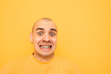 Сlose-гз portrait of the crazy guy from the grillz on his teeth makes a funny face and shocked...