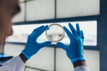 Biologist checking a petri dish with window light