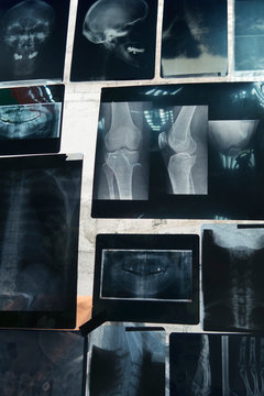 x-rays background
