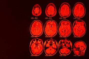 MRI of the brain on a black background with red backlight. Medical background