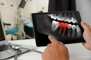 Dentist dental tool to teeth x-ray work Looking At Teeth X-ray On Computer