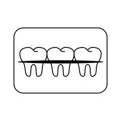 Teeth with braces banner cartoon isolated black and white