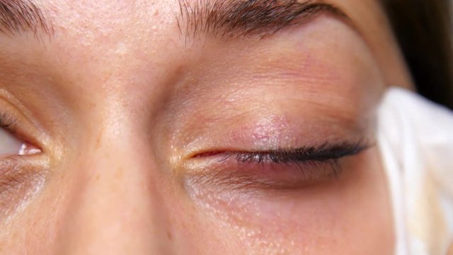Woman removes eye makeup.