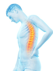 3d rendered medically accurate illustration of a man having acute back pain