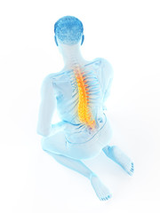 3d rendered medically accurate illustration of a man having acute back pain
