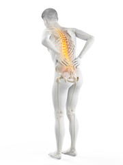 3d rendered medically accurate illustration of a man having acute back pain