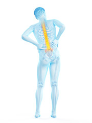 3d rendered medically accurate illustration of a man having acute back pain