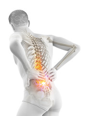 3d rendered medically accurate illustration of a man having acute back pain