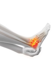 3d rendered medically accurate illustration of a painful ankle