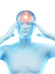 3d rendered medically accurate illustration of a man suffering from headache