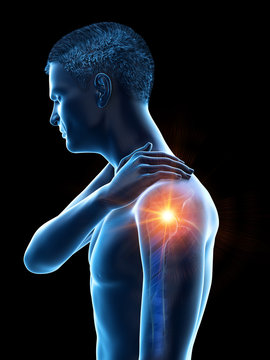 3d rendered medically accurate illustration of a man having a painful shoulder