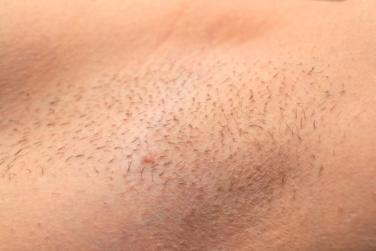 Unshaved armpit close up