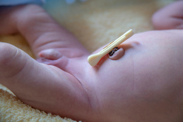 Umbilical cord with clamp of newborn baby