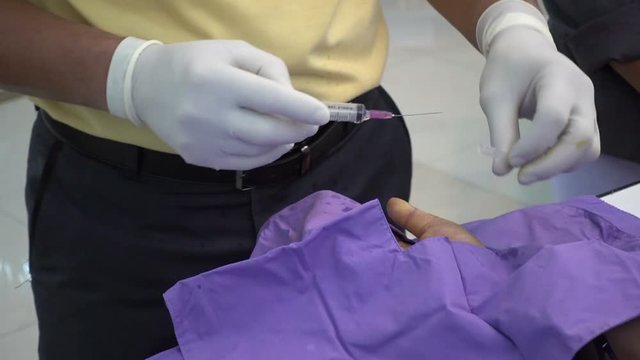Trigger finger operation. Medical treatment , Digital flexer tenosynvitis, Stenosing tenosynvits