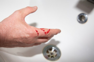 deep cut caused by knife in hand palm finger in home kitchen