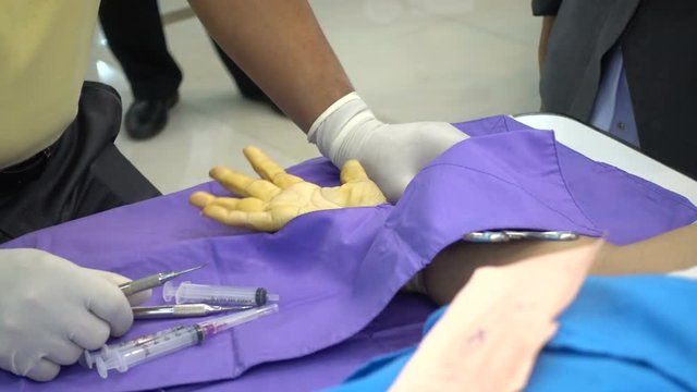 Trigger finger operation. Medical treatment , Digital flexer tenosynvitis, Stenosing tenosynvits