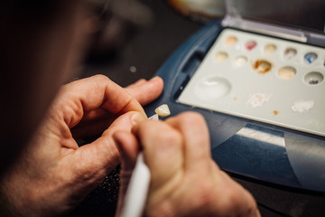 dentist works on tooth crown in dental laboratory. medical concept.