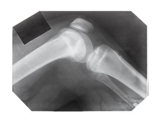 film with X-ray image of knee joint with patella
