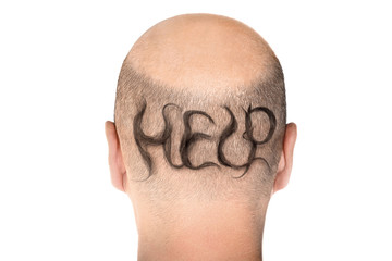 Concept of hair loss. Back view of balding male head isolated on white background. Detail showed...