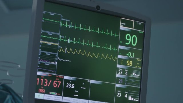 Monitors of vital signs in the intensive care unit