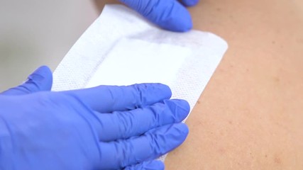 Nurse applying adhesive bandage on scratched shoulder, knife wound, close-up - Powered by Adobe