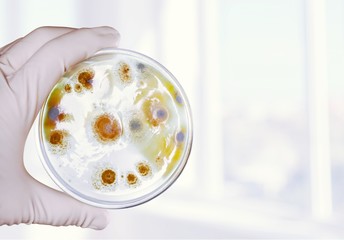 Microbiology laboratory test in scientist hand on background