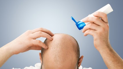 Hair loss scalp adult alopecia background bald - obrazy, fototapety, plakaty