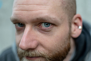 serious looking bearded man looks into the camera