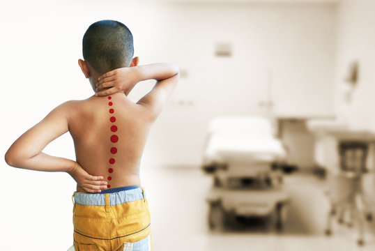 Asian kid with scoliosis