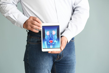 Man holding tablet computer with urinary system on screen against grey background