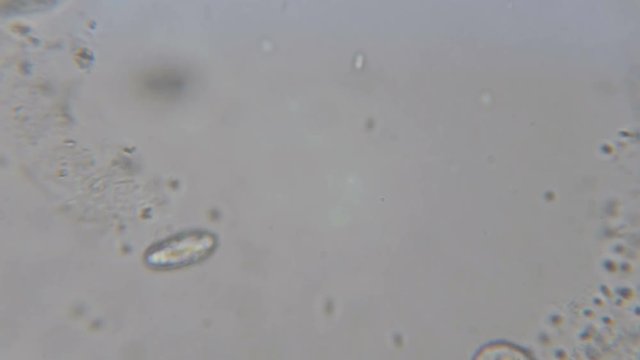 Motion of single-celled animals (infusoria) under microscope. Colony of ciliates Stylonychia under the microscope in lake water. Close up. UHD 4K