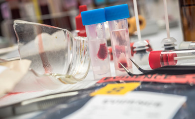 Swabs with blood sample to be analyzed in the laboratory, conceptual image