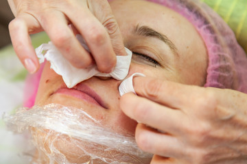 A young girl is lying on a couch during cosmetic procedures with a mask on the face above which beautician woman squeezes body fat and pimples with wipes on cheek. Cleansing and make up.