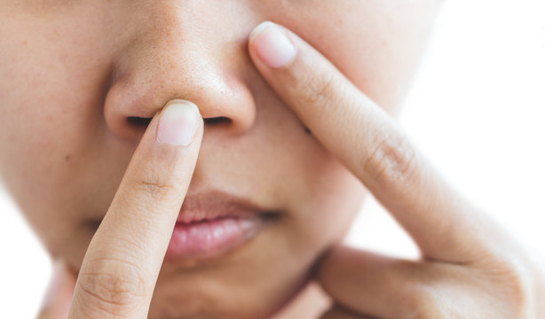 Pores In The Nose Of Women.