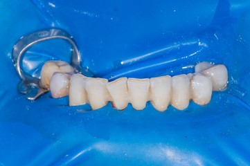 Real patient dental surgery