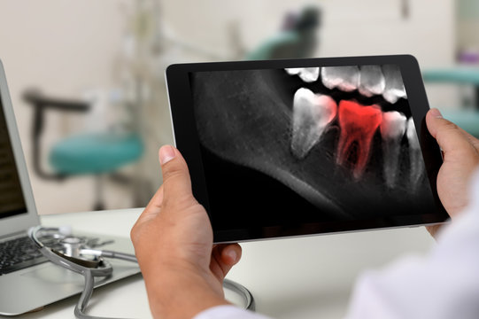 Dentist dental tool to teeth x-ray work Looking At Teeth X-ray On Computer